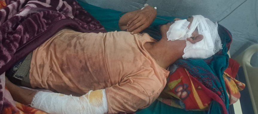 बाघको आक्रमणबाट एक जना गम्भीर घाइते