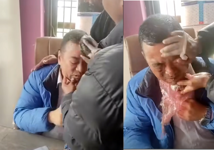 जनकारवाहिका नाममा अनुहारमा मलमुत्र दले